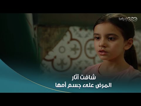 بنت سلمى انهارت لما شافت آثار المرض في جسم أمها فضلت كاتمة العياط وتعبت نفسي ا