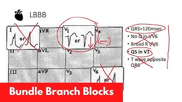 ECG Basics | BBB | For DO, MD, NP, PA [Part 3]