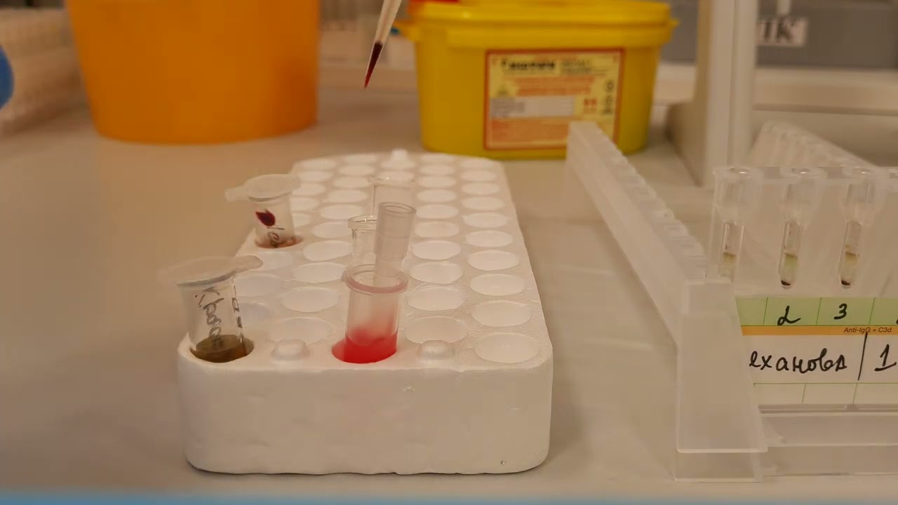 Прямая проба Кумбса (DAT). Практика. - YouTube