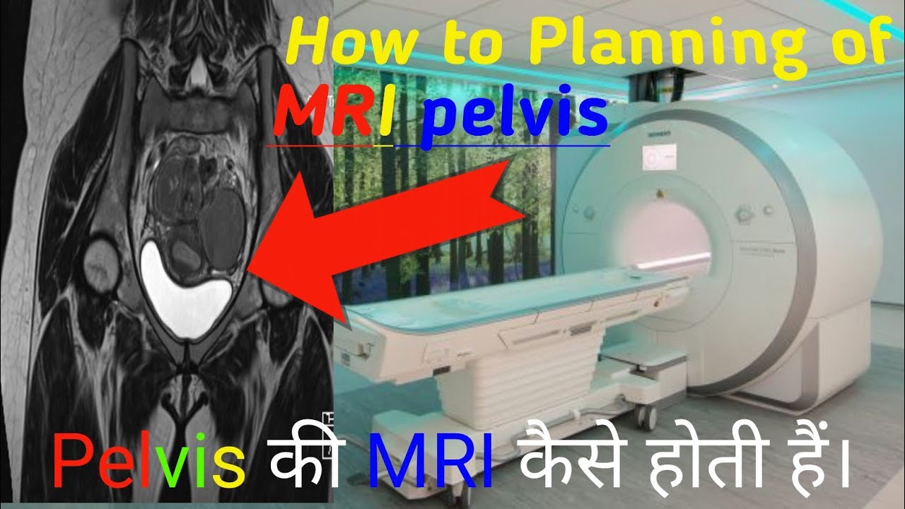 How to planning MRI Pelvis Pelvis की MRI कैसे होती है ।। Haryana MRI