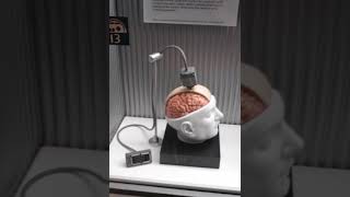 Biomechatronic | Wikipedia audio article