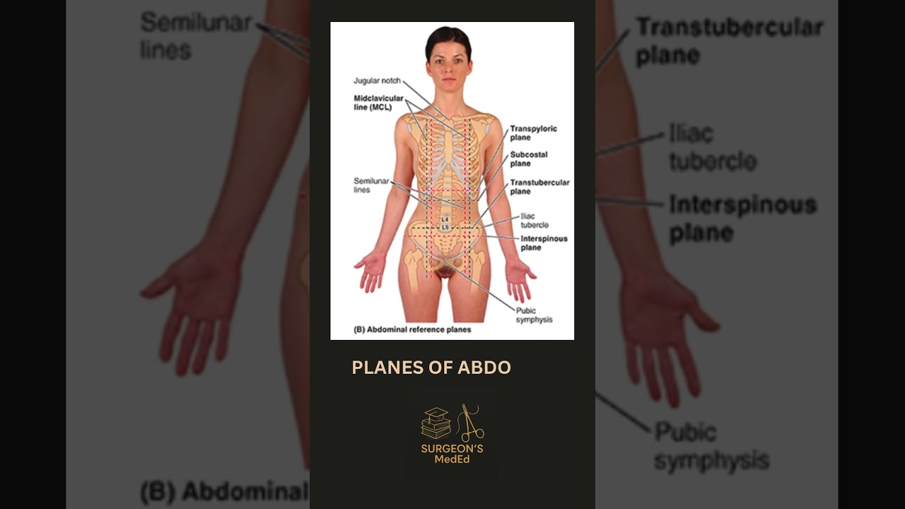 PLANES OF ABDOMEN | To Draw 9 regions of Abdomen | 