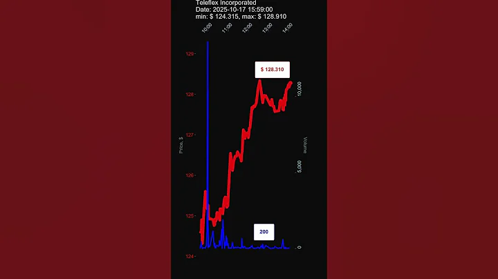 TFX, Teleflex Incorporated, 2025-10-17, stock prices dynamics, stock of the day