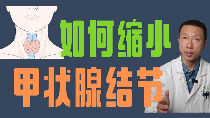 如何縮小甲狀腺結節（良性結節）How to Shrink Thyroid Nodules - 天天要聞