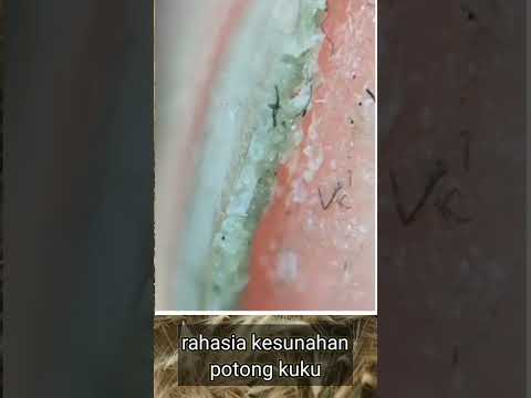 Video: Bolehkah cacing menggigit anda?