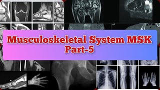 Radiology Viva Cases # 404-408 | Musculoskeletal System Part-5 | MSK #medical #radiology #ultrasound screenshot 3