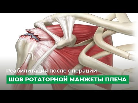 Реабилитация после операции 