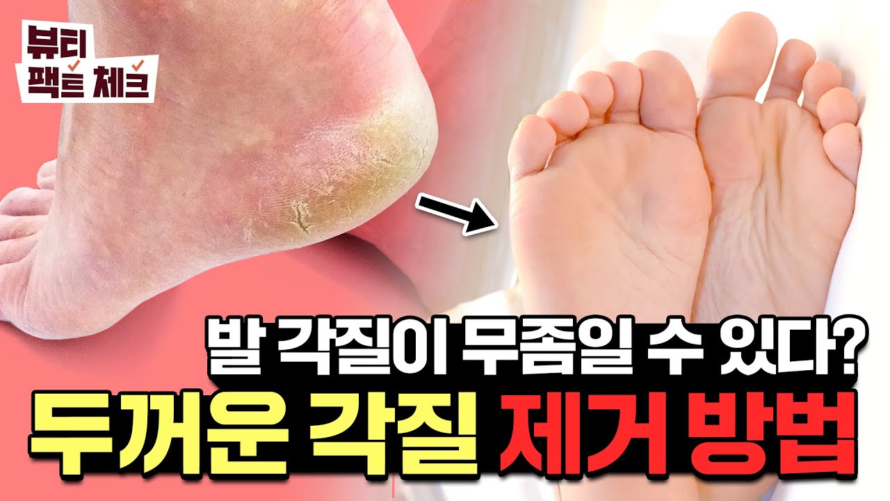 【SUB】발 각질🦶, 아무 증상이 없어도 무좀일 수 있다? 건강한 발 관리법 | 팩트체크 - YouTube