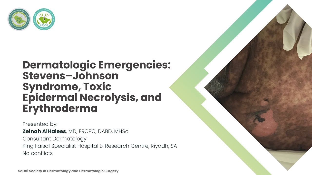 Lecture 17 | Dermatologic Emergencies: SJS, TEN, and Erythroderma | Dr. Zeinah Alhalees