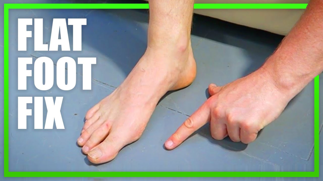 Short Foot Exercise for Flat Feet [Ep48] - YouTube