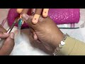 How to do 3 bead method for beginners| acrylic nails for beginners | how to 3 bead method | nails
