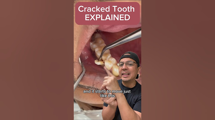 What to Do if You Have a Cracked Tooth | View Mobile Dental #shorts