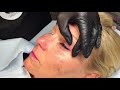 Permanent Makeup Eyeliner Procedure and Camouflage Demonstration