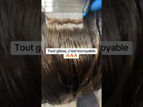 Diagnostiquer la Source du Problème de Lenteur