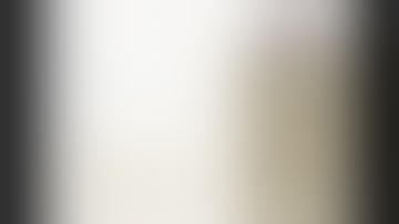 Laparoscopic spleen preserving distal pancreatectomy - Jaideep Raj Rao