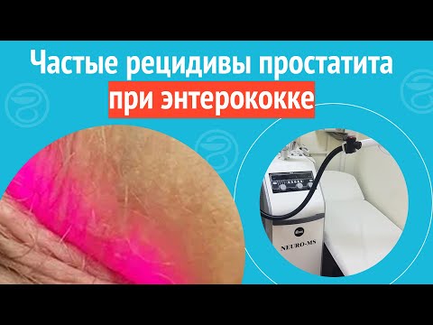 😥 Частые рецидивы простатита при энтерококке. Клинический случай №1231