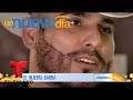 ¡Espinoza Paz se hizo un “transplante” de barba! | Un Nuevo Día | Telemundo