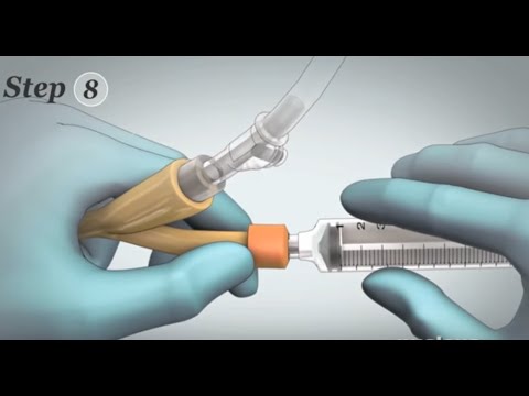 Removal of Foley Catheter (Male)