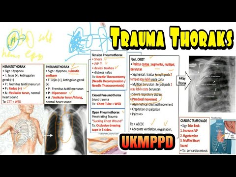 Video: Berapa lama masa yang diambil untuk hemothorax sembuh?