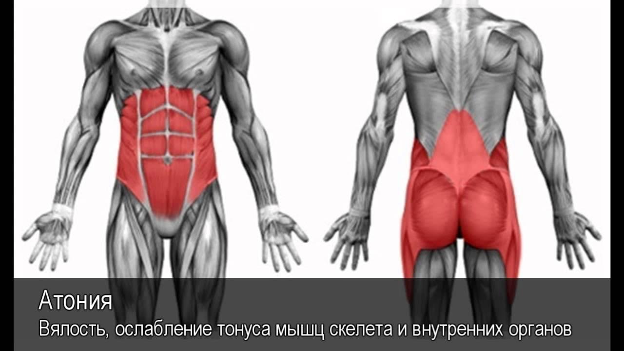 Атония мышц это. Атония мышц это