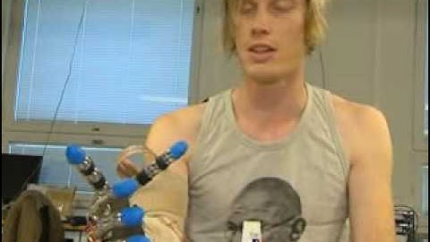 New Bionic Technology Allow Touch Signals in Prosthetic