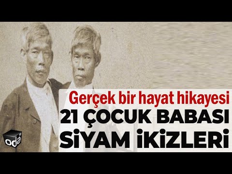 Cinsel hayatları hep merak konusuydu | 21 Çocuk babası Siyam İkizleri