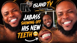Jabass Showing Off His New Teeth 😬 