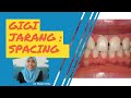 Gigi Jarang/ Renggang/ Spacing