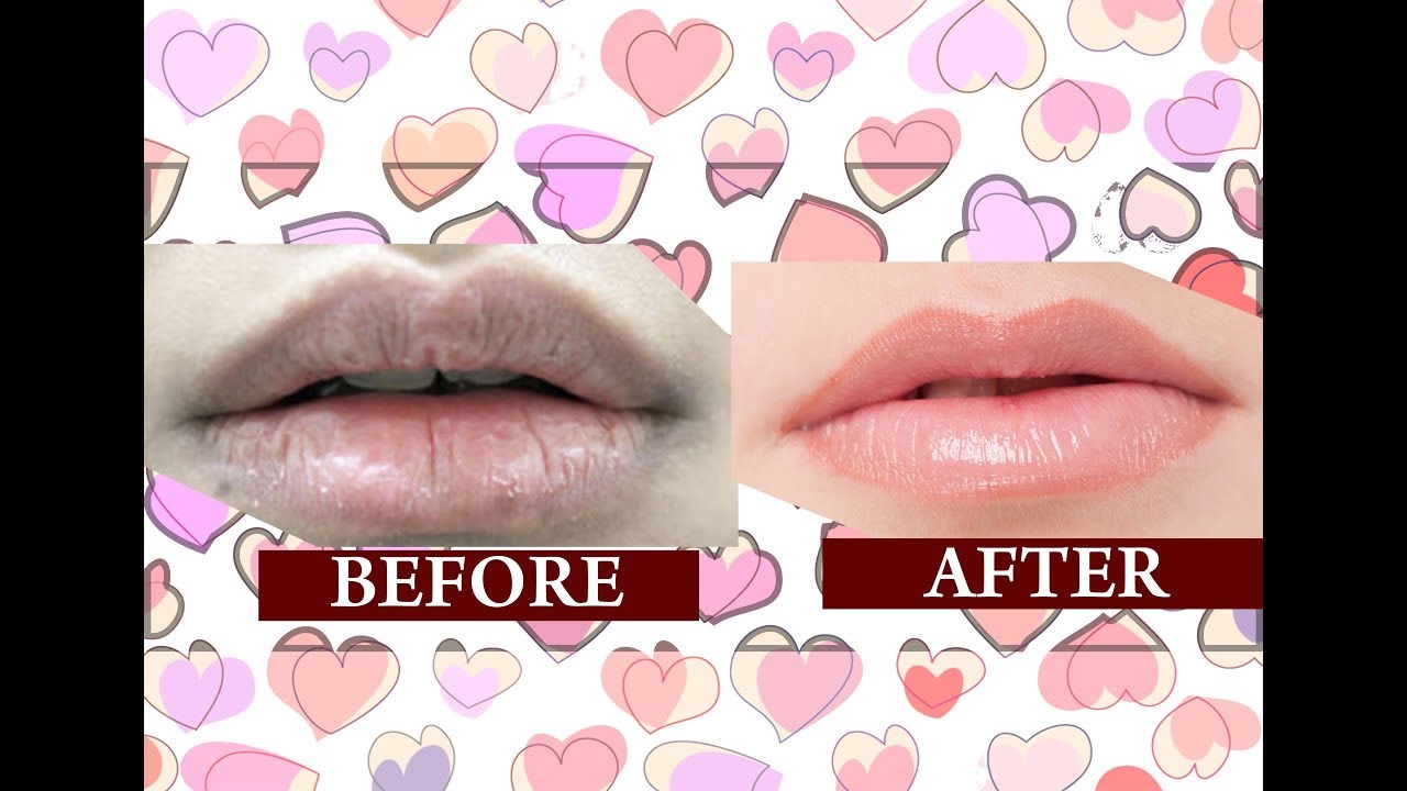 Get Pink Lips Naturally At Home/ DIY Pink Lips/Get Soft Pink Lips skincare routine order