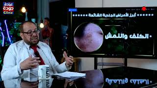 أشهر الأمراض الجلدية | دكتور جودة محمد عواد