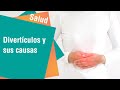 ¿Qué son los divertículos y por qué aparecen? | Salud