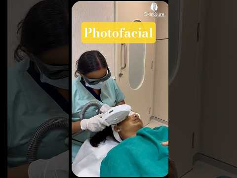 Photofacial in Action ✨ For Brighter, Healthier-Looking Skin #Shorts