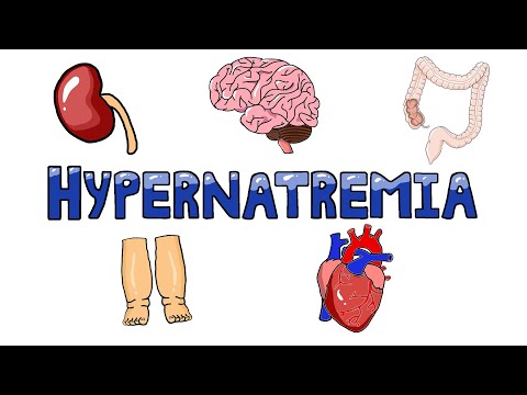 Video: Hypernatremia: Symtom, Behandling, Orsaker Och Mer