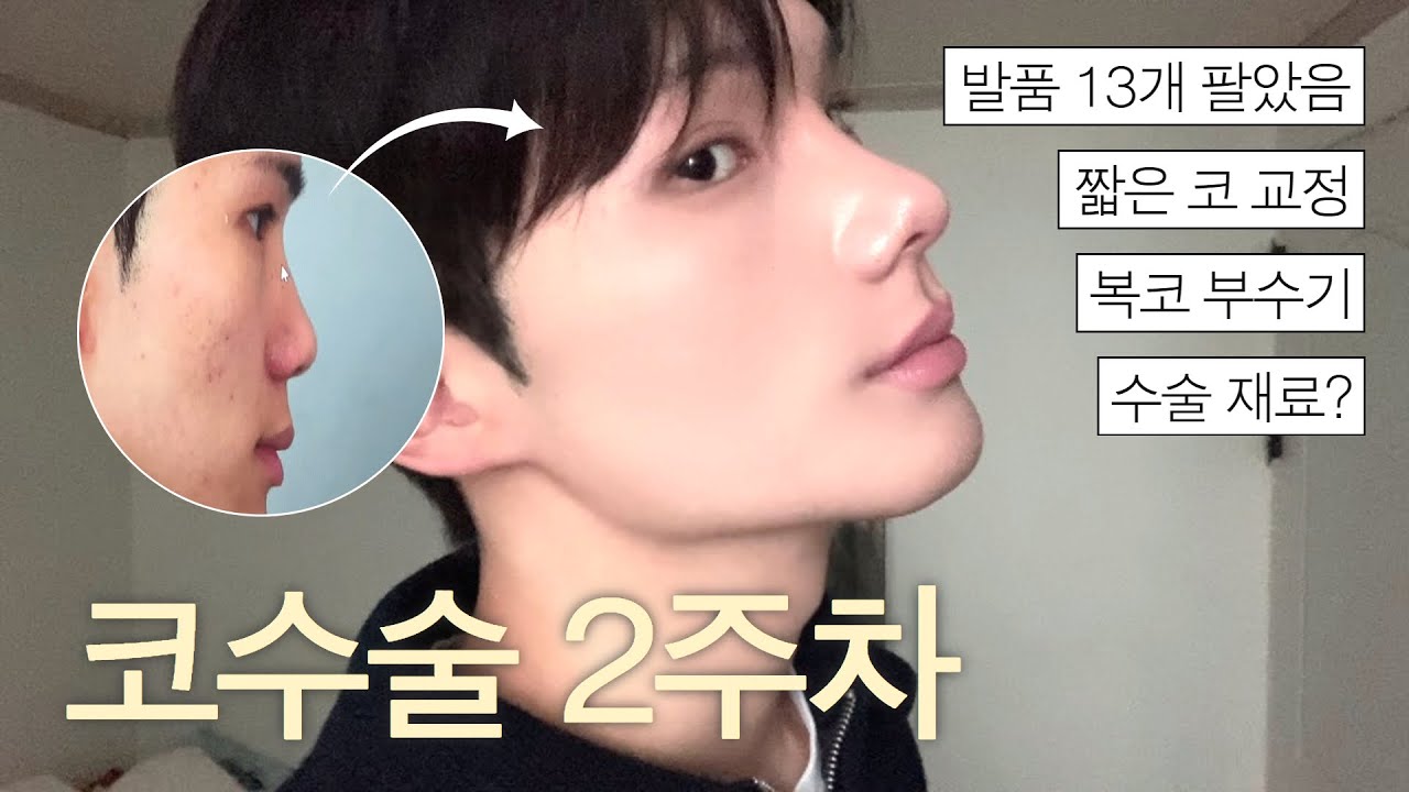 코수술 2주차 대만족 vlog..🌀 | 실리카겔 EOD 콘서트 | 이사배 어드벤처2