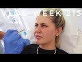 BOTOX BROW LIFT & A MINI HOUSE TOUR - VLOG WEEK 213 | JAMIE GENEVIEVE