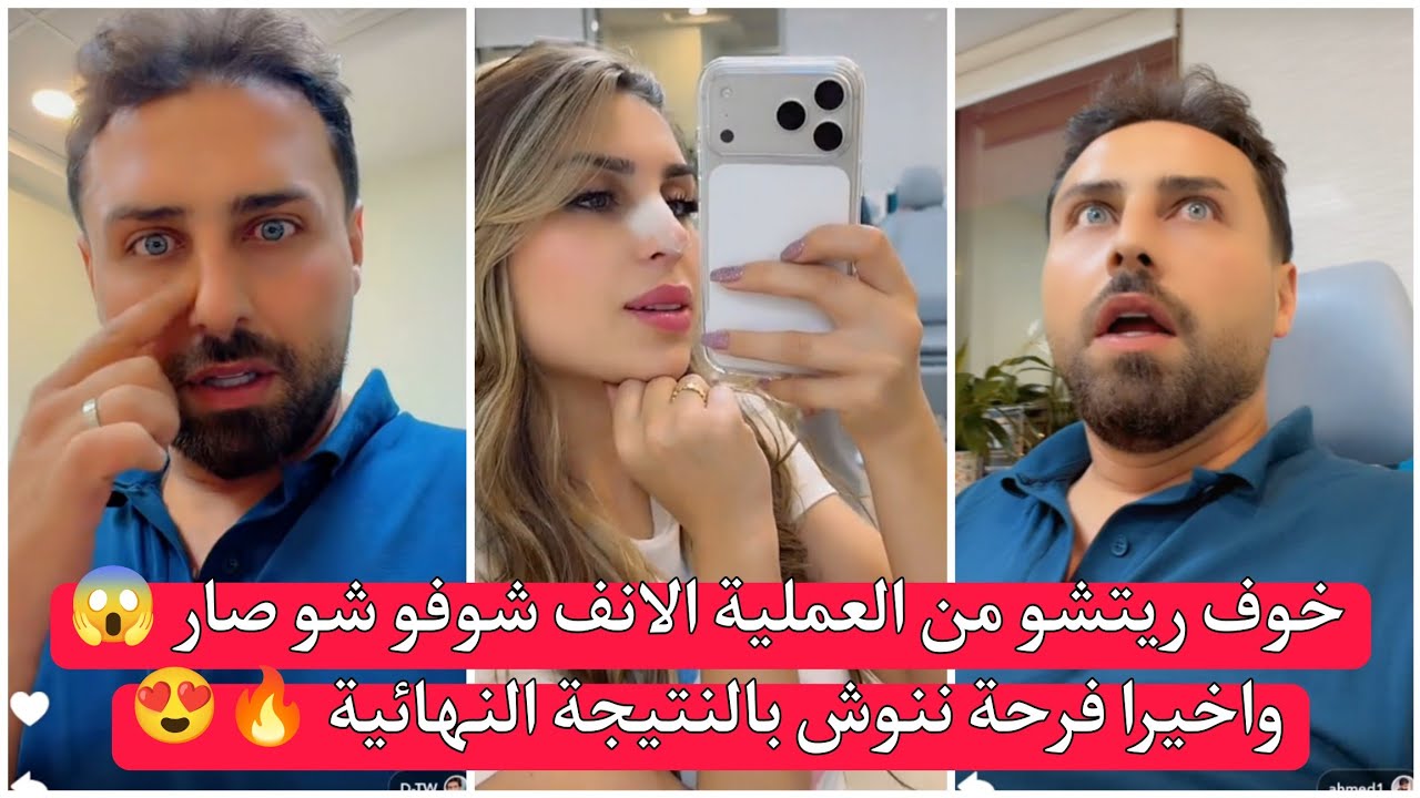 ريتشو وننوش خوف ريتشو من العملية الانف شوفو شو صار 😱 واخيرا فرحة ننوش بالنتيجة النهائية 🔥😍 