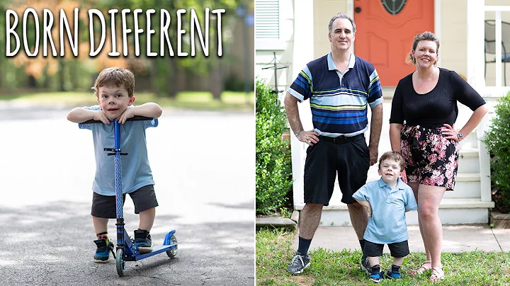 I'm 10 Years Old And Only 2.5ft Tall | BORN DIFFER...