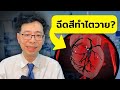ฉีดสีทำให้ไตวาย? จริงหรือ??