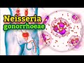 Neisseria gonorrhoeae (English) - Medical Microbiology