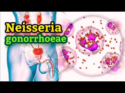 Neisseria gonorrhoeae (English) - Medical Microbiology