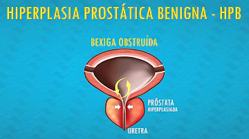 Quantas vezes é normal urinar homem?