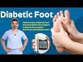 Diabetic Foot Problems - Symptoms, Treatment, and Care | Dr Venugopal Kulkarni - CARE Hospitals