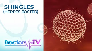 Symptoms, Treatment & Prevention of Shingles (Herpes Zoster) | Doctors on TV