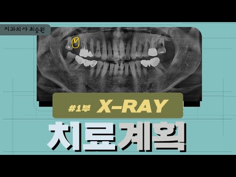 치과 치료계획 / #1부 파노라마 X-ray를 보면서 진단하는 방법