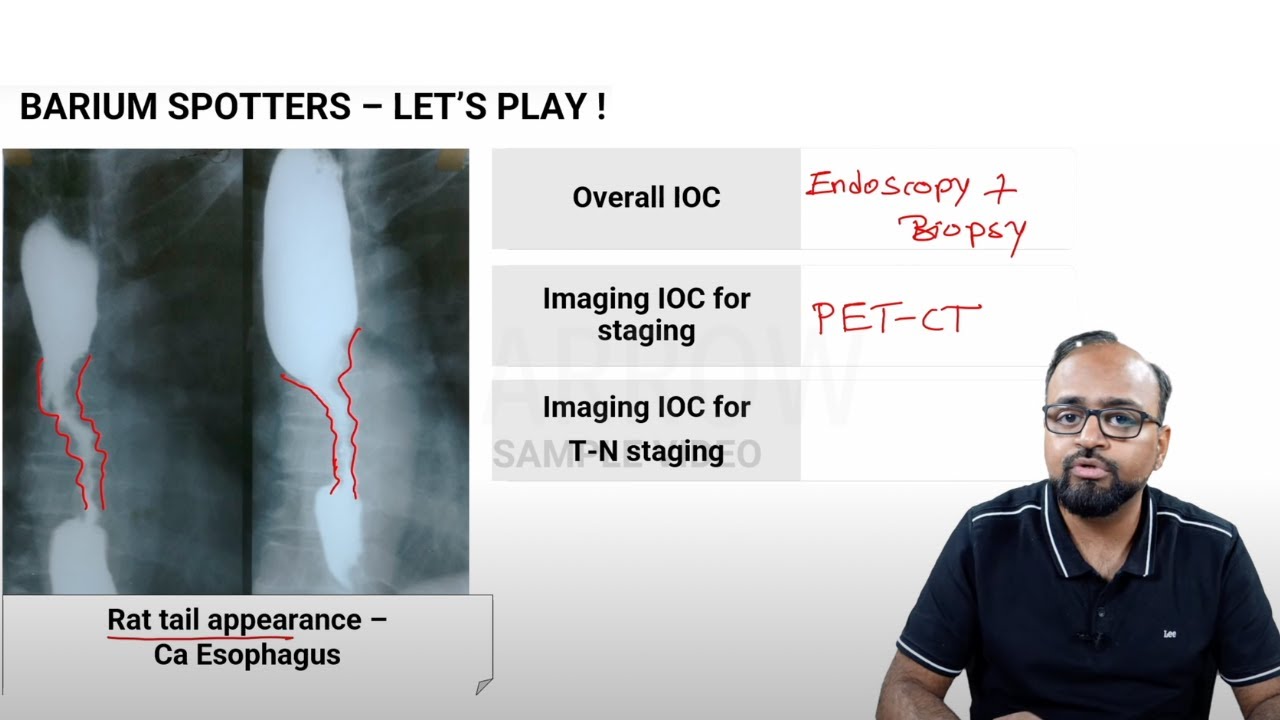 Marrow E6 MCQ Discussion Videos: Radiology Sample Video