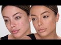 THE BEST WAY TO COVER ACNE WITH MAKEUP - Dilan Sabah