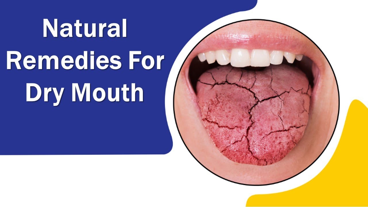 Dry Mouth Remedy Best Natural Remedies For Dry Mouth YouTube