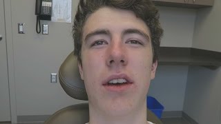 Vignette de la vidéo "FUNNY WISDOM TEETH AFTERMATH ( Tooth Removal Video w/ TheCampingRusher )"