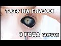 ЧТО СЛУЧИЛОСЬ С МОИМИ ГЛАЗАМИ спустя 3 года?