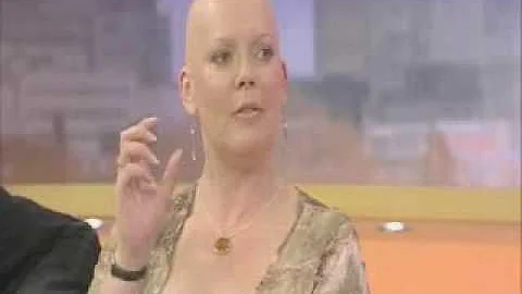 Michelle Chapman promotes alopecia awareness